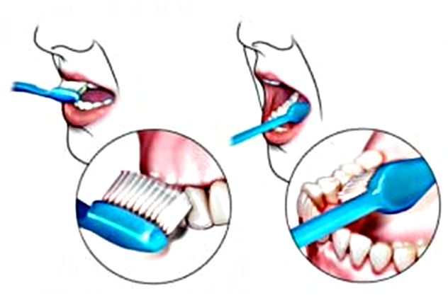 A megfelelő  fogkefe használat